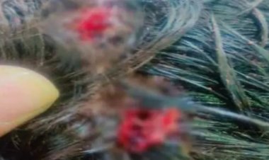 रायपुर रेलवे स्टेशन पर 5 लुटेरों ने घेरकर युवक के सिर पर चाकू से हमला कर दिया